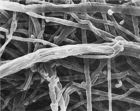numerous strands of hyphae interwoven in all directions and filling the entire image; some are wound together as in a rope while others are individual hyphal strands