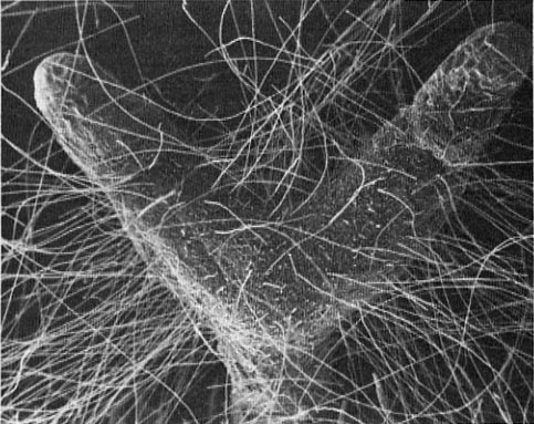 Y-shaped structure (pine ectomycorrhiza) with numerous hair-like hyphae radiating out in all directions
